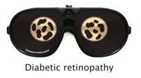 diabetic retinoipathy